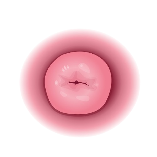 Cervix
